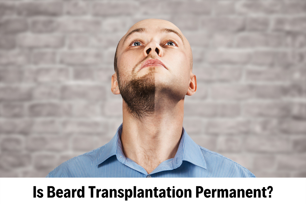 Beard Transplant